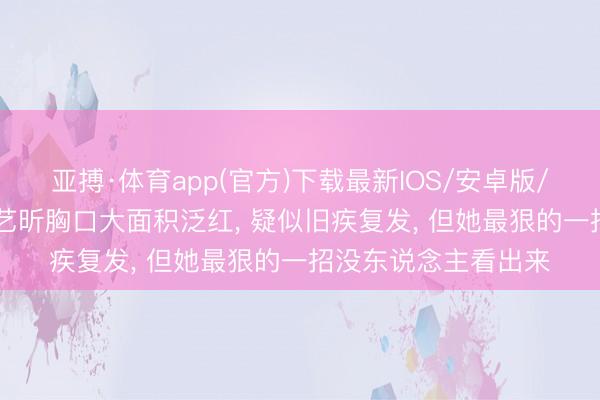 亚搏·体育app(官方)下载最新IOS/安卓版/手机版APP下载 唐艺昕胸口大面积泛红, 疑似旧疾复发, 但她最狠的一招没东说念主看出来